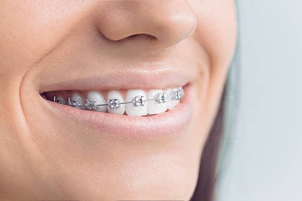 Best Wisdom Tooth Removal  in Kinsey, AL